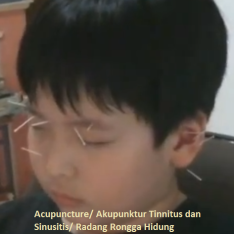 Menderita Tinnitus dan Sinusitis, Michael usia 9 tahun.
